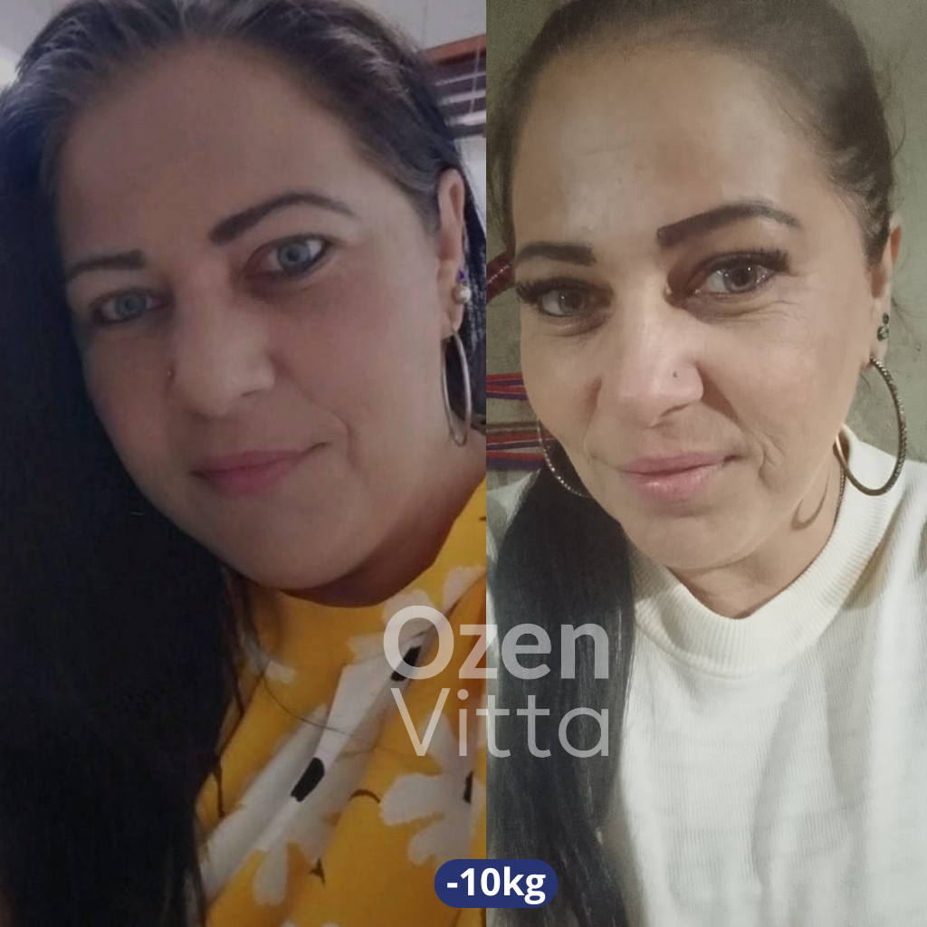 Depoimento Alessandra -10kg